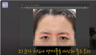 요즘 쌍꺼풀 안하는 상상초월 이유/ 쌍꺼풀 대신 이거합니다 사진 20