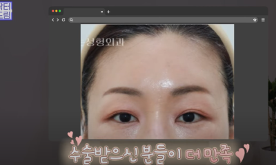 요즘 쌍꺼풀 안하는 상상초월 이유/ 쌍꺼풀 대신 이거합니다 사진 27