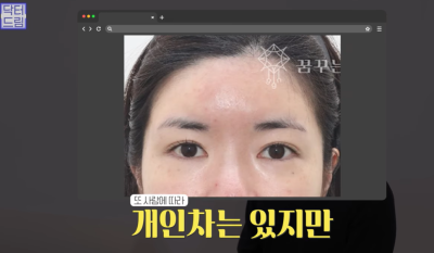 요즘 쌍꺼풀 안하는 상상초월 이유/ 쌍꺼풀 대신 이거합니다 사진 11