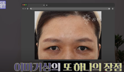 요즘 쌍꺼풀 안하는 상상초월 이유/ 쌍꺼풀 대신 이거합니다 사진 28