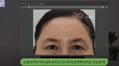 요즘 쌍꺼풀 안하는 상상초월 이유/ 쌍꺼풀 대신 이거합니다 사진 18
