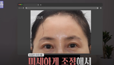 요즘 쌍꺼풀 안하는 상상초월 이유/ 쌍꺼풀 대신 이거합니다 사진 19