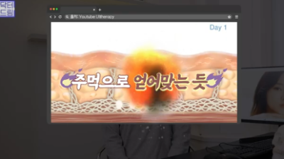 레이저 아플수록 효과가 좋을까요?