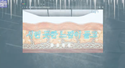 레이저 아플수록 효과가 좋을까요? 사진 14
