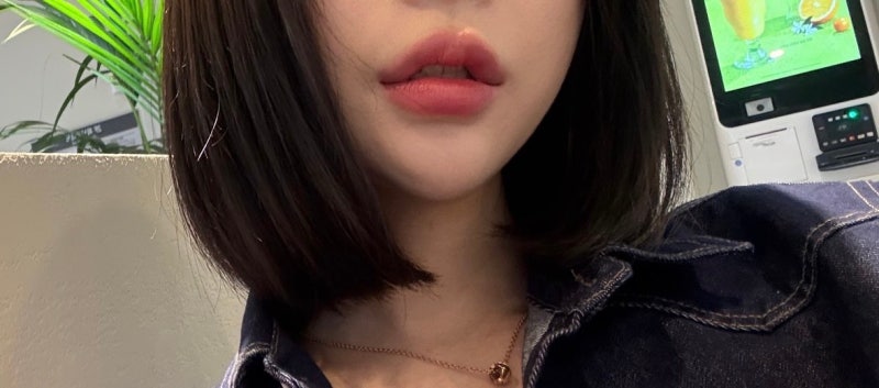 강남역 입술필러 장인을 찾는다면? = 꿈꾸는 성형외과! 💋✨ 사진 4