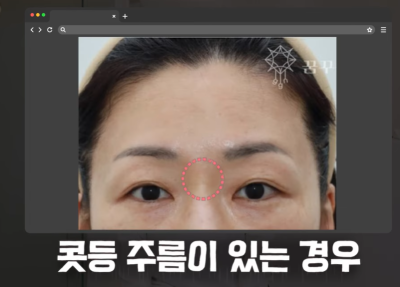이마거상 좋은건 알겠는데 너무 무서워요 사진 22