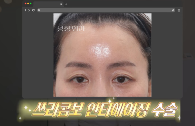 이마거상 좋은건 알겠는데 너무 무서워요 사진 4