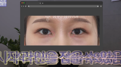 [연예인쌍꺼풀 공식] 나에게 어울리는 쌍꺼풀 찾기 사진 6