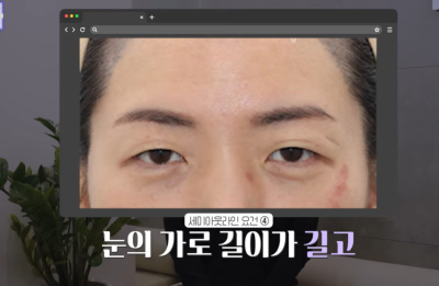 [연예인쌍꺼풀 공식] 나에게 어울리는 쌍꺼풀 찾기 사진 11