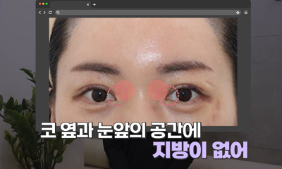 [연예인쌍꺼풀 공식] 나에게 어울리는 쌍꺼풀 찾기 사진 12