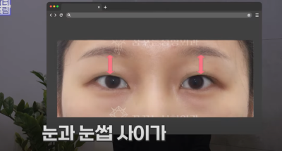 [연예인쌍꺼풀 공식] 나에게 어울리는 쌍꺼풀 찾기 사진 8