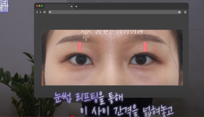 [연예인쌍꺼풀 공식] 나에게 어울리는 쌍꺼풀 찾기 사진 9