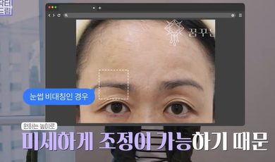 남편도 모르는 티안나는 극강의효과 동안성형 이마거상 사진 19