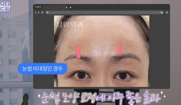 남편도 모르는 티안나는 극강의효과 동안성형 이마거상 사진 20