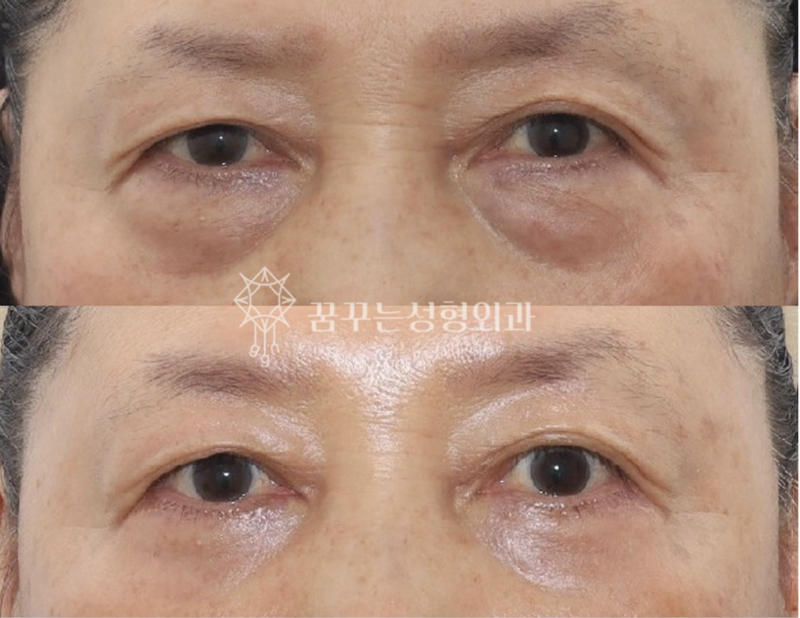 강남 중년 안티에이징, 우아하게 나이들고 싶다면 사진 13