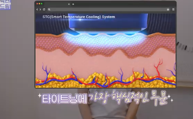 여름에도 모공없는 매끈도자기피부 만드는 방법 사진 17