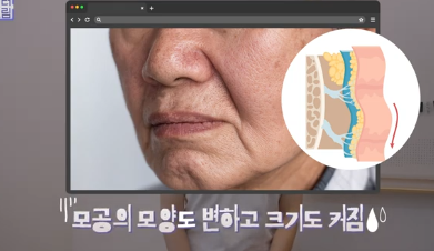 여름에도 모공없는 매끈도자기피부 만드는 방법 사진 5