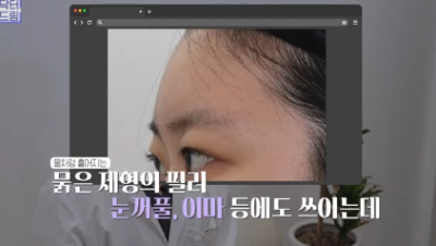 필러로 석사딴 원장이 깨달은 '진짜' 콜라겐부스터 사진 7