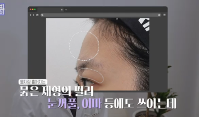 필러로 석사딴 원장이 깨달은 '진짜' 콜라겐부스터 사진 6