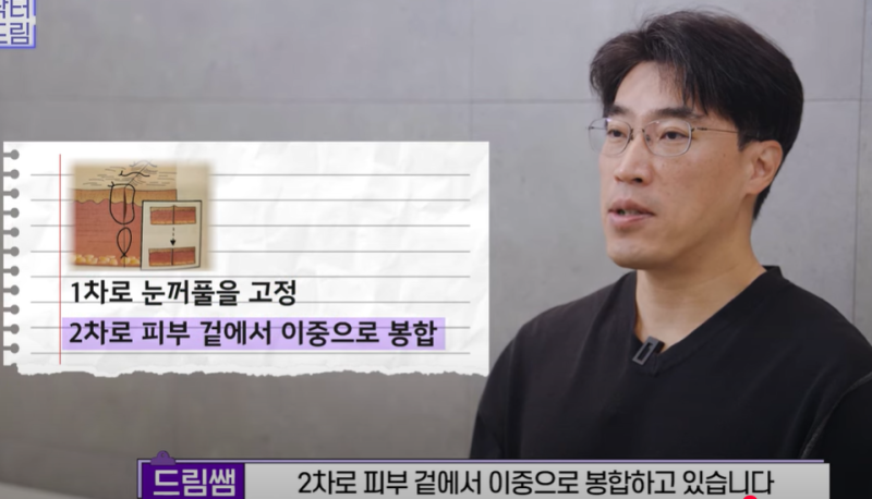 속시원한 중년쌍꺼풀의 진실, 이걸몰라서 제친구가 망했군요 사진 26
