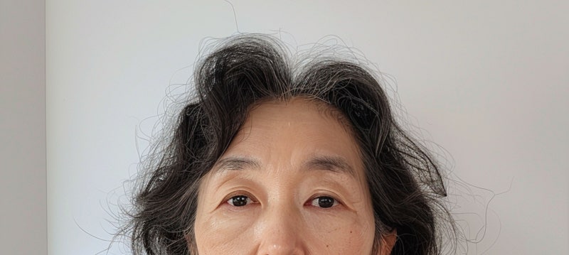 강남역 중년성형에도 트렌드가 있다. 사진 3