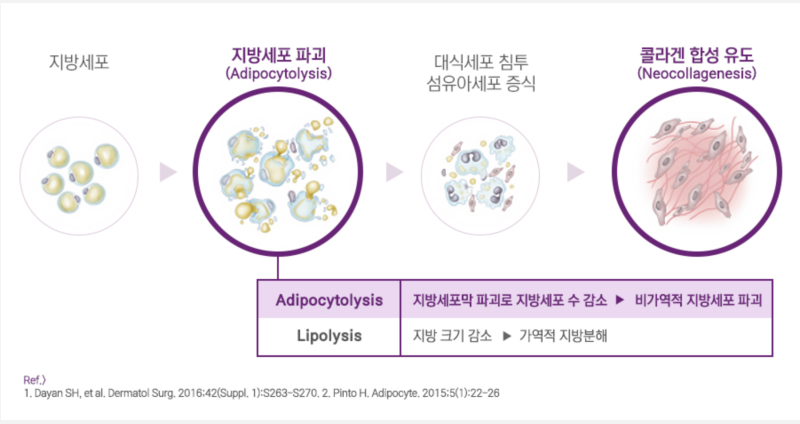 강남역 브이올렛 후기,이중턱 고민 깔끔하게 해결.