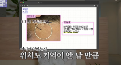 이마거상받고 3년지났는데...이거 어떡하죠? 원장아내가 받은 이마거상 후기 사진 7