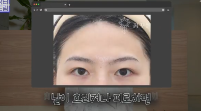 이마거상받고 3년지났는데...이거 어떡하죠? 원장아내가 받은 이마거상 후기 사진 14