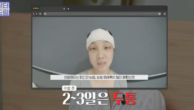 이마거상받고 3년지났는데...이거 어떡하죠? 원장아내가 받은 이마거상 후기 사진 20