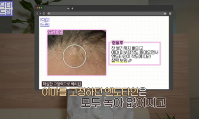 이마거상받고 3년지났는데...이거 어떡하죠? 원장아내가 받은 이마거상 후기 사진 6