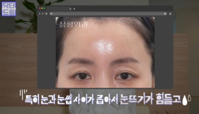 이마거상받고 3년지났는데...이거 어떡하죠? 원장아내가 받은 이마거상 후기 사진 13
