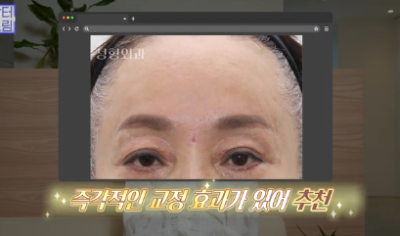이마거상받고 3년지났는데...이거 어떡하죠? 원장아내가 받은 이마거상 후기 사진 19