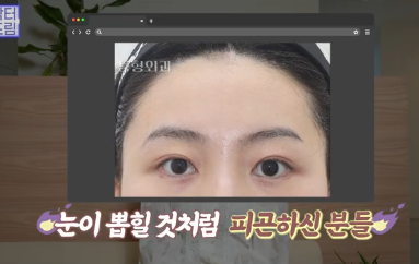이마거상받고 3년지났는데...이거 어떡하죠? 원장아내가 받은 이마거상 후기 사진 15