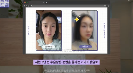 이마거상받고 3년지났는데...이거 어떡하죠? 원장아내가 받은 이마거상 후기 사진 3