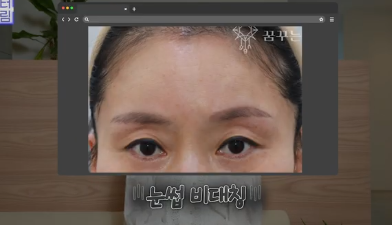 이마거상받고 3년지났는데...이거 어떡하죠? 원장아내가 받은 이마거상 후기 사진 16