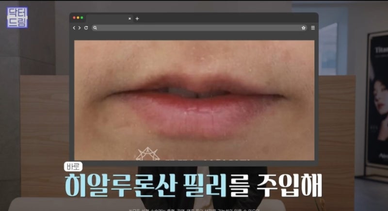 맘카페에서 뽑은 말섞기싫은 인상 1위, 너 좀 고집세 보여 사진 8