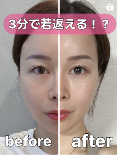 강남역 이마거상 잘하는 병원? 챗GPT에게 물어봤다 사진 6