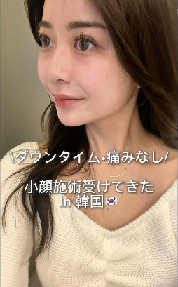 강남역 티타늄리프팅, 어디서 해야 후회 없을까? 티타늄레이져 후기 사진 17