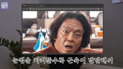 우리아빠 10살 어려보이는 중년남성 눈성형의 모든 것 사진 6