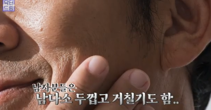우리아빠 10살 어려보이는 중년남성 눈성형의 모든 것 사진 7