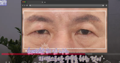 우리아빠 10살 어려보이는 중년남성 눈성형의 모든 것 사진 11