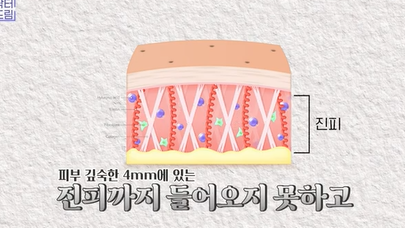 콜라겐 한 달 안먹으니 이렇게 됐습니다 .콜라겐 진짜 효과 있나요? 사진 9