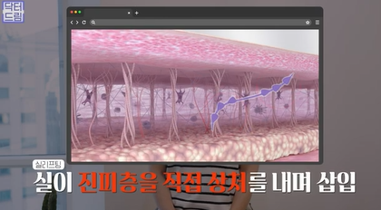 콜라겐 한 달 안먹으니 이렇게 됐습니다 .콜라겐 진짜 효과 있나요? 사진 18