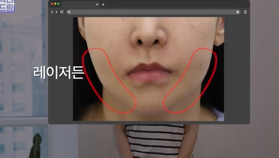 콜라겐 한 달 안먹으니 이렇게 됐습니다 .콜라겐 진짜 효과 있나요? 사진 19