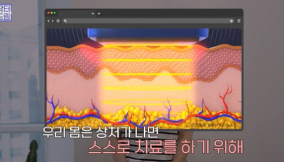 콜라겐 한 달 안먹으니 이렇게 됐습니다 .콜라겐 진짜 효과 있나요? 사진 16