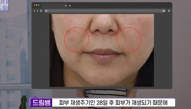 콜라겐 한 달 안먹으니 이렇게 됐습니다 .콜라겐 진짜 효과 있나요? 사진 21