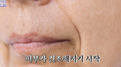 콜라겐 한 달 안먹으니 이렇게 됐습니다 .콜라겐 진짜 효과 있나요? 사진 5