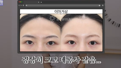평생 딱 한번만 할 수 있는 수술
