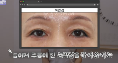 평생 딱 한번만 할 수 있는 수술 사진 3