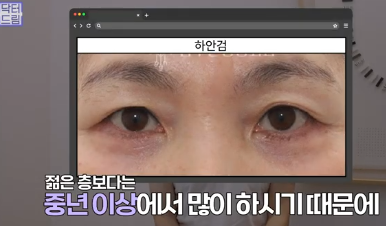 평생 딱 한번만 할 수 있는 수술 사진 13